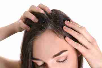 Dandruff - PCR Testing -1